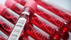 Kreatin Nedir ? Nasıl Çalışır ?