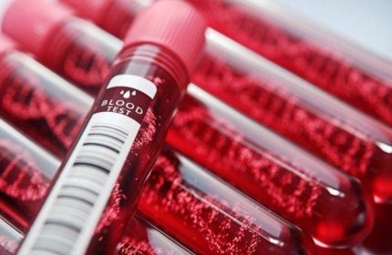 Kreatin Nedir ? Nasıl Çalışır ?